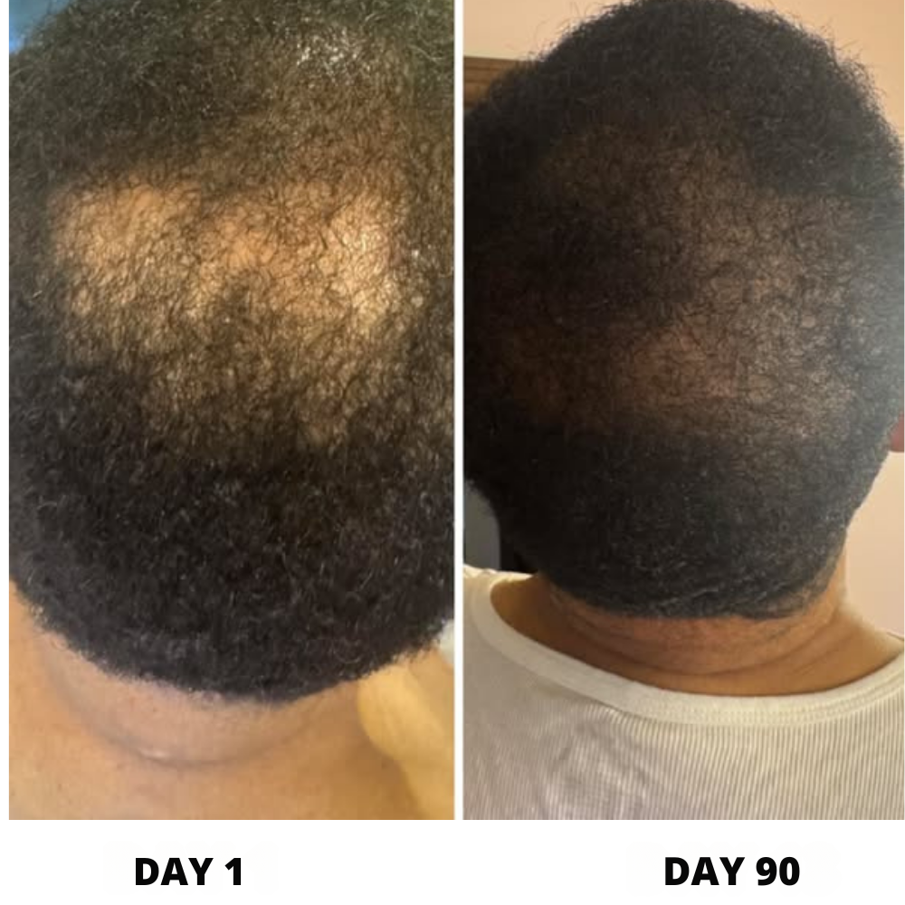 ThryveLabs Hair Growth Serum